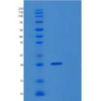 人前列腺素D2合成酶(PTGDS)重组蛋白