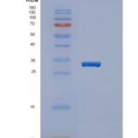 人过氧化物酶体增殖物激活受体γ(PPARg)重组蛋白