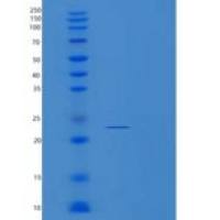 人多功能肽酶2(PSMB9)重组蛋白