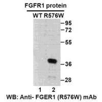 FGFR1(R576W)