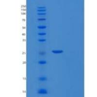 人非ATP酶蛋白酶体26S亚基9(PSMD9)重组蛋白