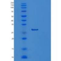 人蛋白酶体亚基α6(PSMa6)重组蛋白