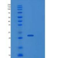 人线粒体蛋白酪氨酸磷酸酶1(PTPMT1)重组蛋白