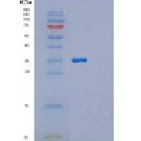人蛋白磷酸酶1调节因子亚基3B(PPP1R3B)重组蛋白