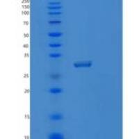 人蛋白酶体亚基α3(PSMa3)重组蛋白