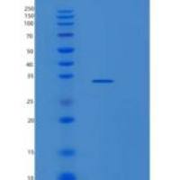 人非受体型蛋白酪氨酸磷酸酶4(PTPN4)重组蛋白