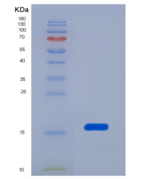 人转甲状腺素蛋白(PALB)重组蛋白
