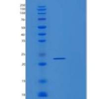 人前列腺素E合酶2(PTGES2)重组蛋白