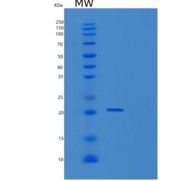 人蛋白酪氨酸磷酸酶ⅣA1(PTP4A1)重组蛋白