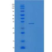 人蛋白酶体亚基α4(PSMa4)重组蛋白