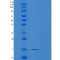 人Profilin 1重组蛋白