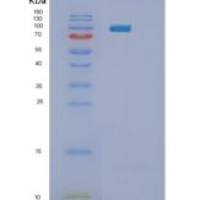 人糖原磷酸化酶L(PYGL)重组蛋白