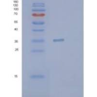 人PYCR1重组蛋白