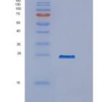 人磷酸泛酰半胱氨酸脱羧酶(PPCDC)重组蛋白