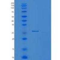 人PSMB1重组蛋白