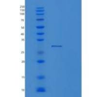 人蛋白酶体亚基α5(PSMa5)重组蛋白