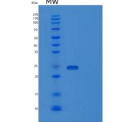 人蛋白酪氨酸磷酸酶ⅣA2(PTP4A2)重组蛋白