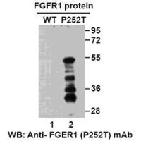 FGFR1(P252T)