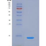 人趋化因子 (C-X-C基序)配体7( CXCL7)重组蛋白