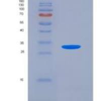 人加溶金属蛋白酶1(MP1)重组蛋白