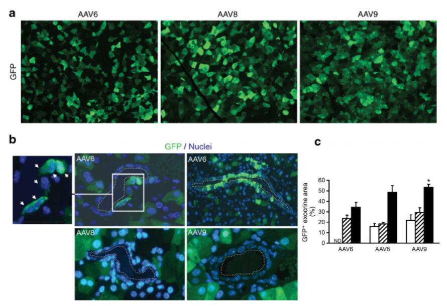 AAV在胰腺疾病研究中的靶向递送策略