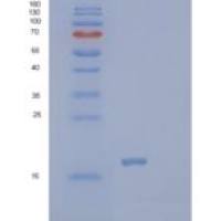 人PTRHD1重组蛋白