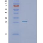 人蛋白酶体亚基α2(PSMa2)重组蛋白