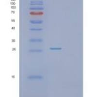 人蛋白酶体亚基α2(PSMa2)重组蛋白