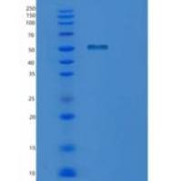 人PPM1F重组蛋白