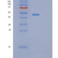 人妊娠特异性β1-糖蛋白(PSG1)重组蛋白
