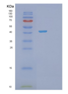 人磷酸丝氨酸转氨酶1(PSAT1)重组蛋白