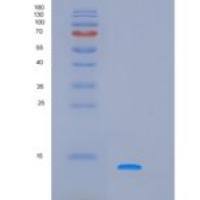 人酸性唾液脯氨酸丰富磷蛋白1(PRH1)重组蛋白