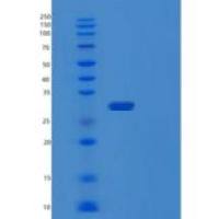 人蛋白酶激活亚基2(PSME2)重组蛋白