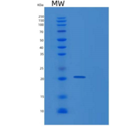 人蛋白酪氨酸磷酸酶ⅣA1(PTP4A1)重组蛋白