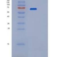 人PPP2R1A重组蛋白
