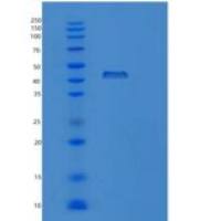 人PRPSAP2重组蛋白