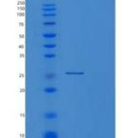 人丝氨酸蛋白酶3(PRSS3)重组蛋白
