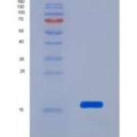 人转甲状腺素蛋白(PALB)重组蛋白