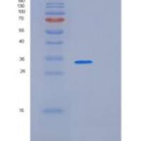 人多聚谷氨酰胺结合蛋白1 (PQBP1)重组蛋白