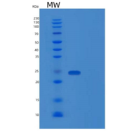 人蛋白酪氨酸磷酸酶ⅣA2(PTP4A2)重组蛋白