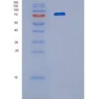 小鼠蛋白精氨酸甲基转移酶1(PRMT1 isoform2)重组蛋白