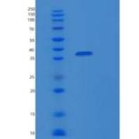人PTP-1B蛋白酪氨酸磷酸酶1B重组蛋白