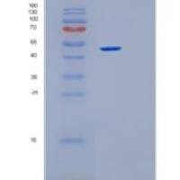 人PRKACB重组蛋白