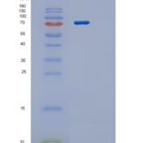 人蛋白精氨酸甲基转移酶1(PRMT1 isoform3)重组蛋白