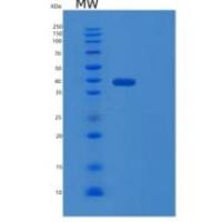 人PTGR2重组蛋白