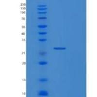 人RNF114重组蛋白