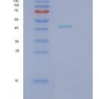 人肾素(REN)重组蛋白