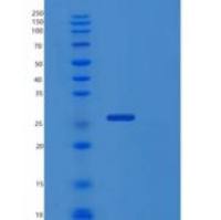 人蛋白信号调节因子17(RGS17)重组蛋白