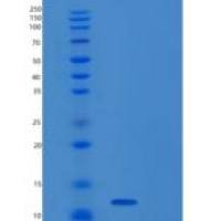 人受体活性修饰蛋白3(RAMP3)重组蛋白