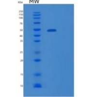 小鼠突触受体关联蛋白(RAPSN)重组蛋白